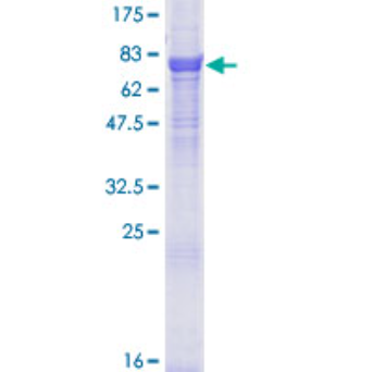 12.5% SDS-PAGE Stained with Coomassie Blue.
